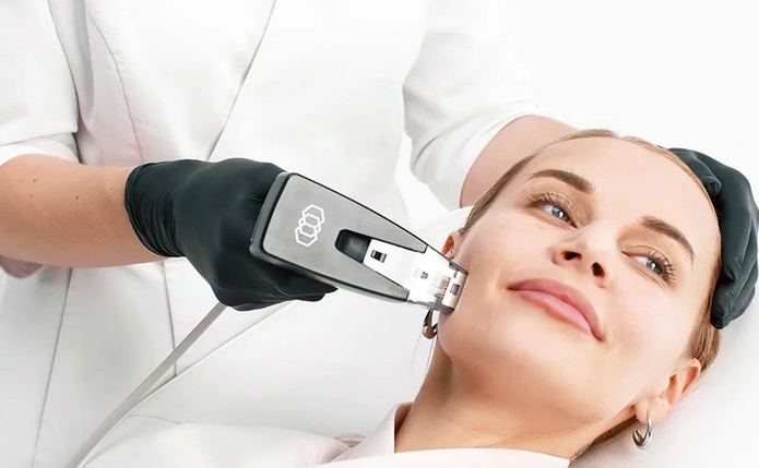 Morpheus8 for Microneedling with radio frequency in Chatsworth, los Angeles