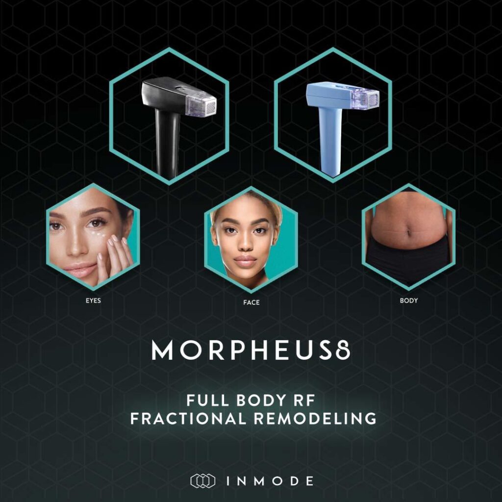 Morpheus8 for Microneedling with radio frequency in Chatsworth, los Angeles